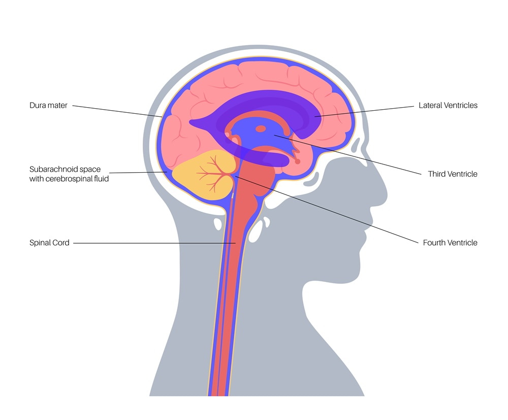 Ventricular_system_131000 為了治療老寒腿，意外治好八十歲母親的輕度失智