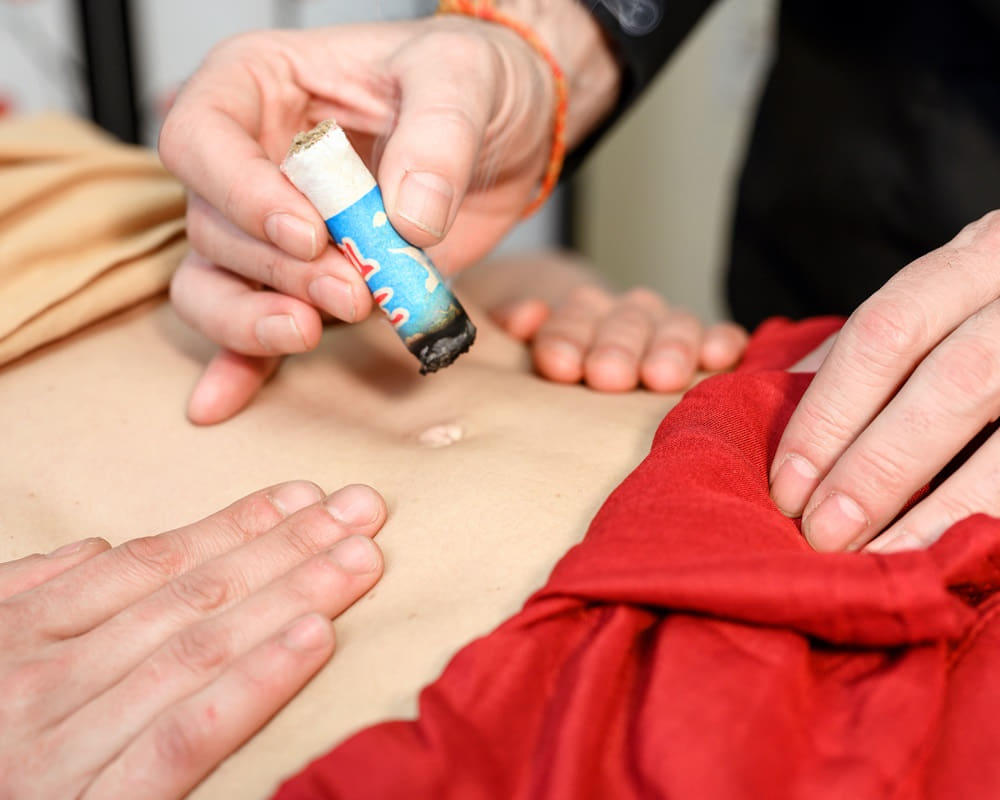 alternative-therapist-applying-moxibustion-traditional-chinese-medicine-method1000800 「夏至」的節氣芳療養生法:一忌體表的涼,二忌體內的涼