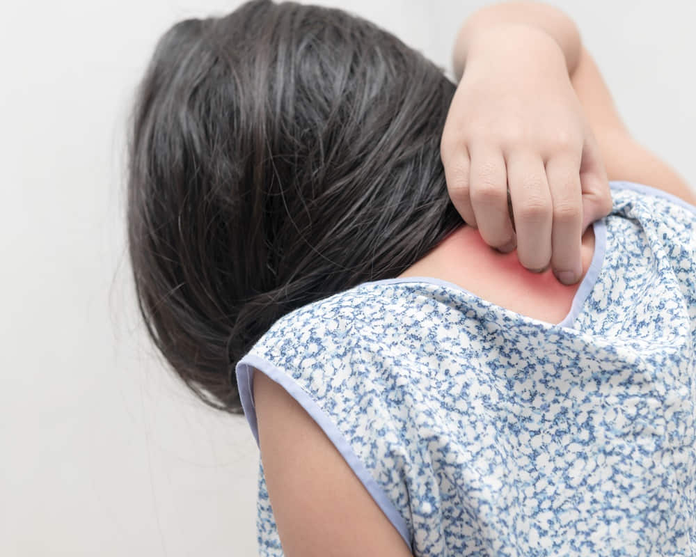 girl-scratch-itch-with-hand-concept-with-healthcare-medicine1000800 壓力如何傷害你的肌膚？從荷爾蒙到免疫系統的全面解析
