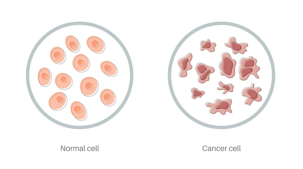 Tumor_101000 癌症的真相,看懂了癌症的前因後果 ,不再輕信癌症的謠言