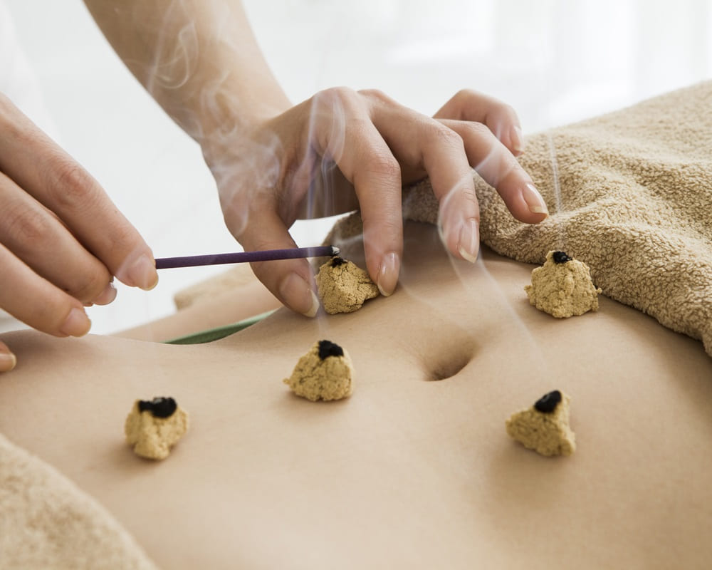 shutterstock_moxibustion-251320126_tcm1000800 中醫如何看腫瘤的生成與治療