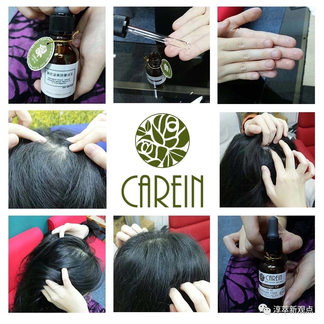 S__48259088 越努力的人越掉髮嗎？