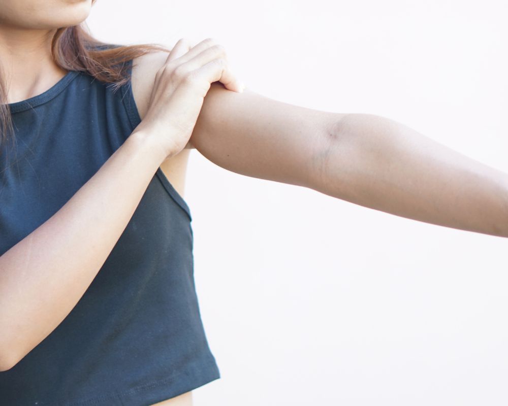 307 中醫怎麼看待蕁麻疹，皮膚癢疹